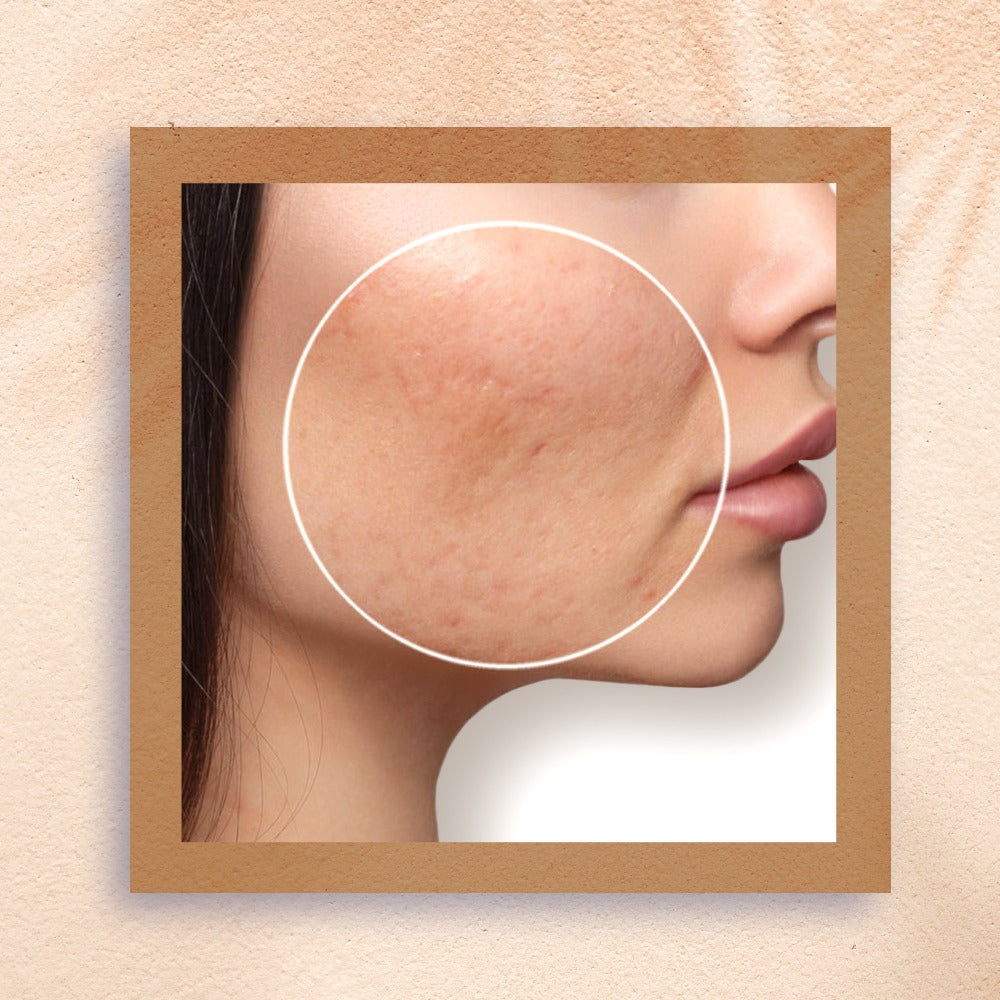 Ishna Natural Ubtan Powder