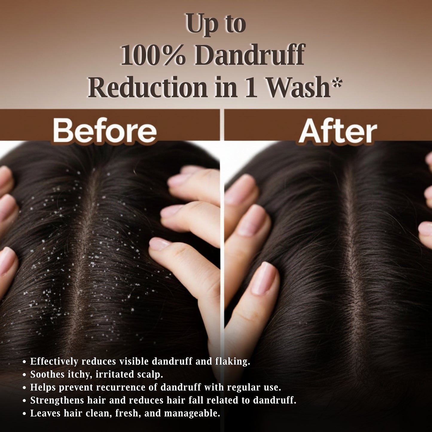 Srikesh Anti dandruff shampoo