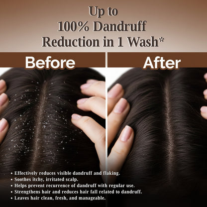 Srikesh Anti dandruff shampoo